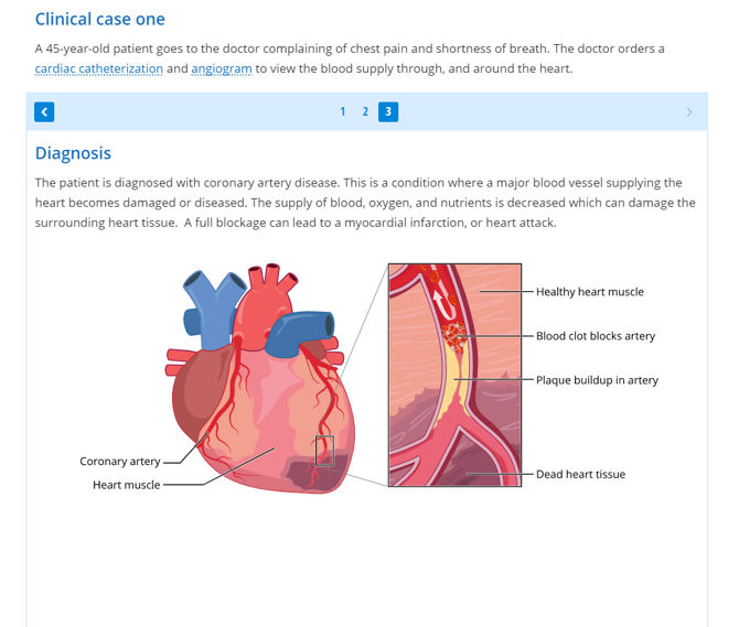 Heart Dissection Lt Anatomy Collection ADI